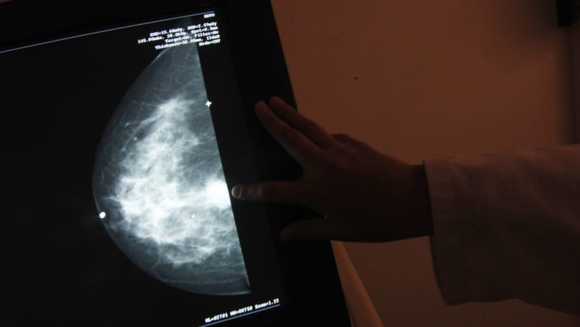 Breast cancer survivor thought she ‘could live with one breast’, but later felt incomplete