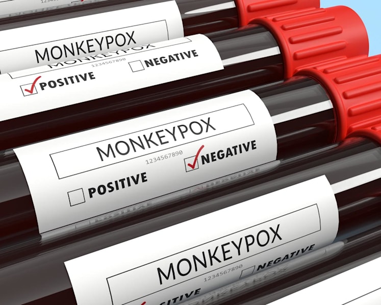 Singapore reports 13th case of monkeypox infection since June