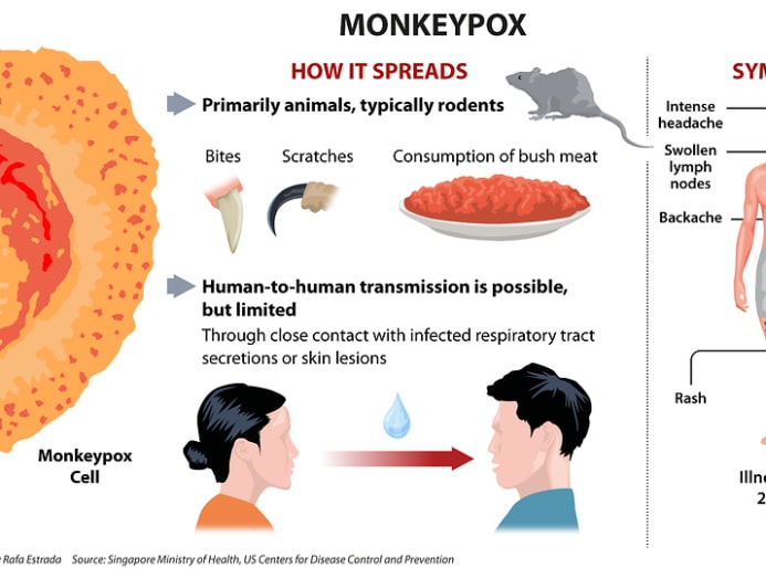 First monkeypox case in Singapore: What you need to know about the ...