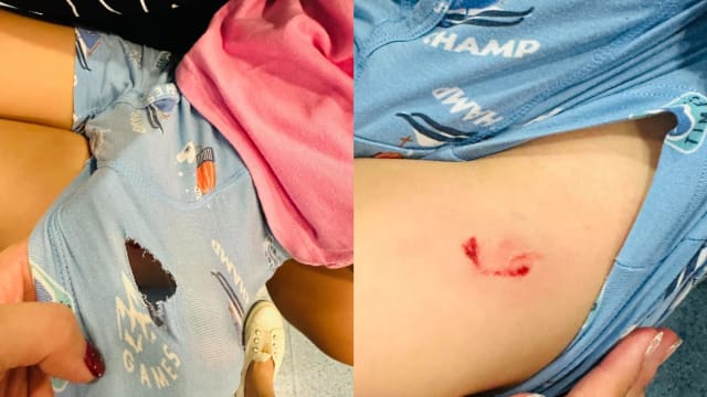四岁男童滨海湾花园遭狗咬 家长网寻狗主担责