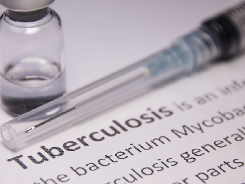 Commentary: Coercive measures to improve tuberculosis control may raise stigma — being more people-centred will help