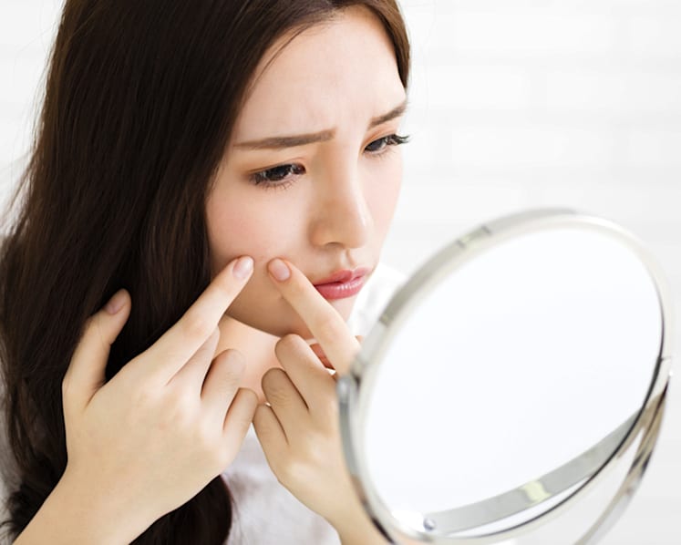 Thinking of popping that pimple? Don’t!