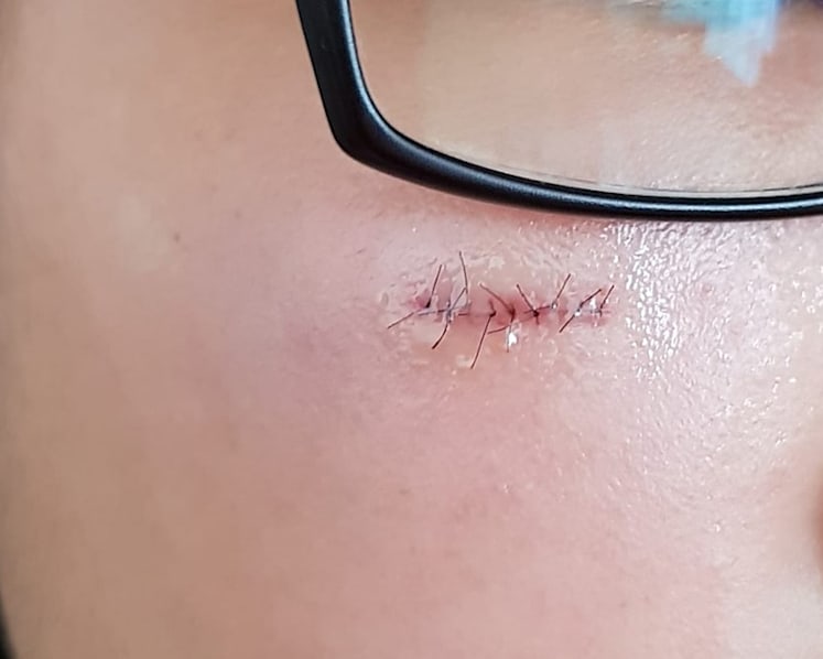 Teenager injured while playing at Jewel's Mirror Maze attraction