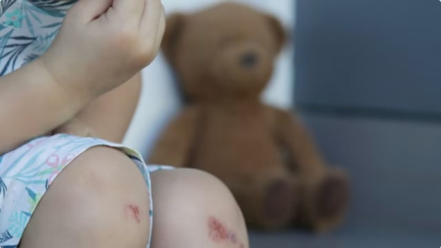 把雇主三岁女当出气筒 女佣虐童罪成判监20个月