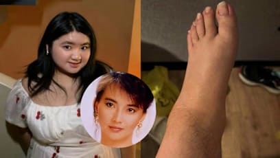 Daughter Of '80s Taiwanese Actress Hu Huichung Praised For Showing Her Unshaven Legs In Pics