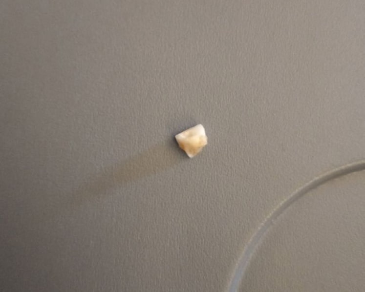Singapore Airlines apologises after passenger finds 'human tooth' in his meal