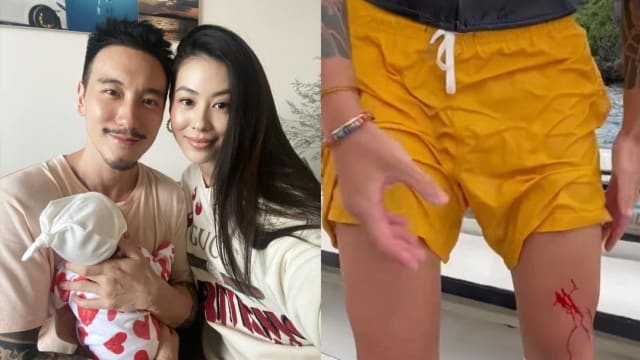 与蔡诗芸传婚变　王阳明潜水受伤鲜血直流！