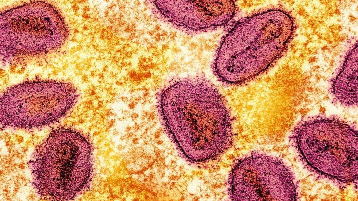 Singapore confirms two locally transmitted mpox cases; authorities say risk to public is low