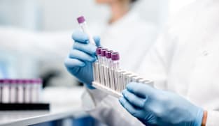 Commentary: Your leftover blood samples are valuable to science – but they are often discarded