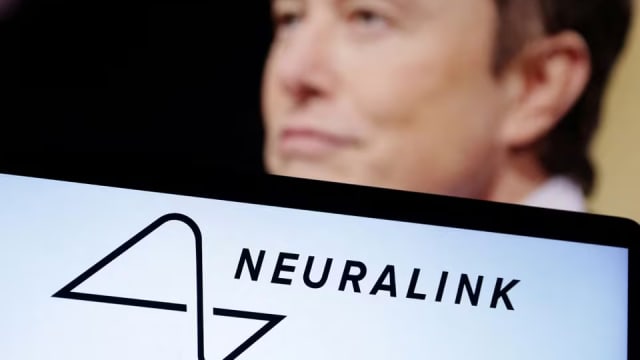 病人脑内植入Neuralink晶片 马斯克称可凭意念操纵滑鼠
