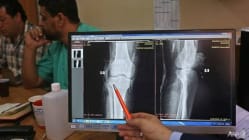 Related article image