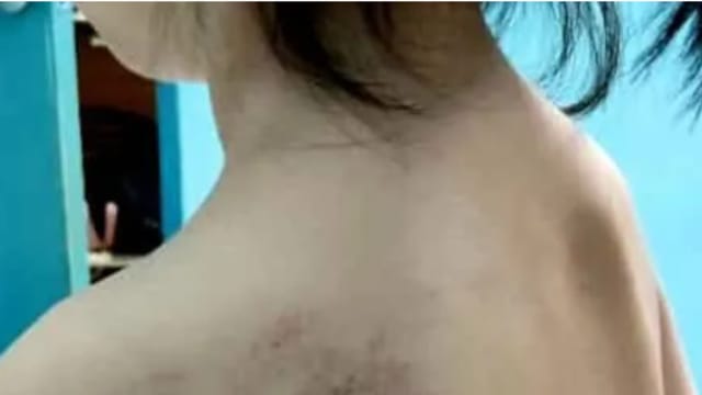 失控抽打女童导致多处瘀青 马国教师公开道歉 