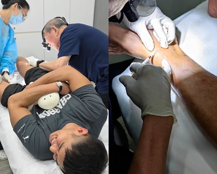 Elvin Ng had to get steroid jabs for sandfly bites after they became inflamed