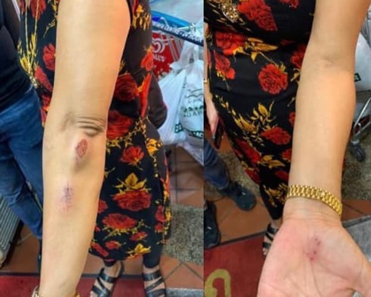 PM Lee and several ministers speak out against alleged racist attack on woman along Choa Chu Kang Drive