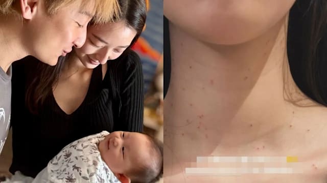 方力申太太叶萱颈部布满红斑，揭真相后获赞！