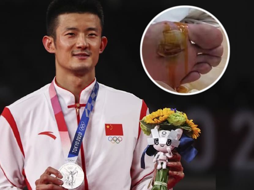 Chinese Olympic Shuttler Chen Long Was Called &ldquo;Useless&rdquo; For Not Winning Badminton Gold; Coach Reveals How Badly Blistered His Feet Were During Match