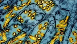 New Zealand confirms first H5N1 bird flu case in native bird