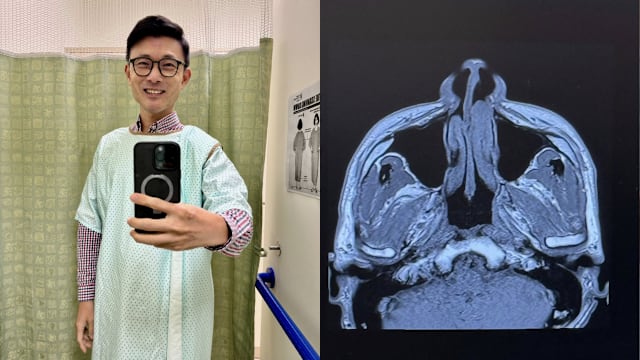 癌症治疗后第四年 马炎庆：一切正常