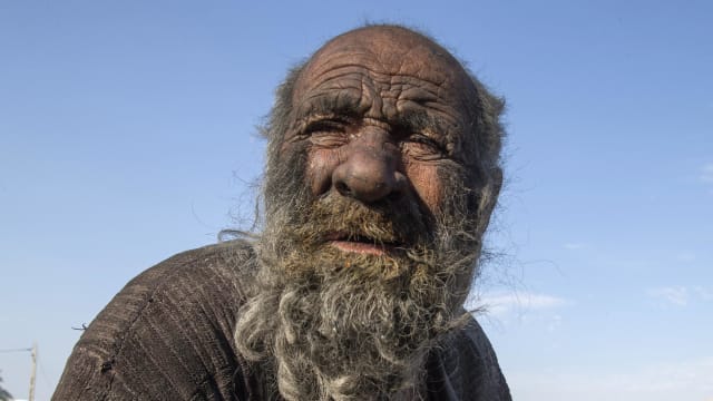 被称为全球最肮脏人逝世 伊朗男子享年94岁