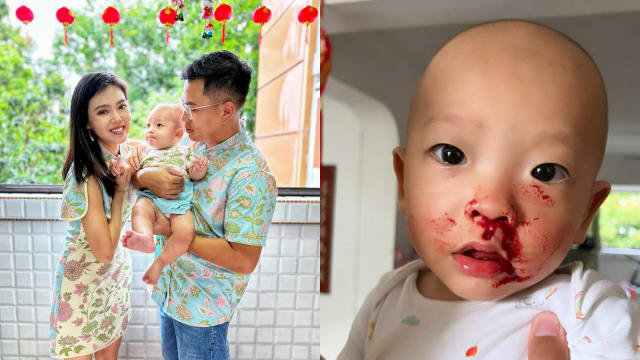 晒儿子满面鼻血照　谢静仪：把我吓得魂不附体