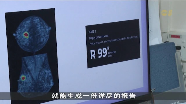 机构运用人工智能检测 更快速准确发现乳腺癌