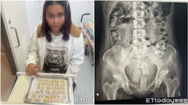 为免费游台湾和赚钱 泰两女吞食塞肛大量海洛因被捕