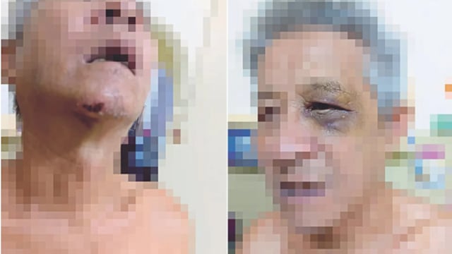 马国路怒男子殴打辱骂仅罚款 伤者家属质疑刑罚过轻