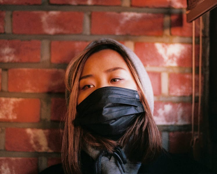 Having an acne flare-up? Here’s how you can control it.