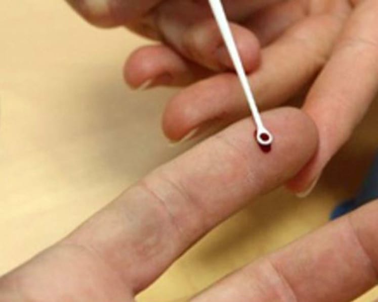 What is hepatitis C?