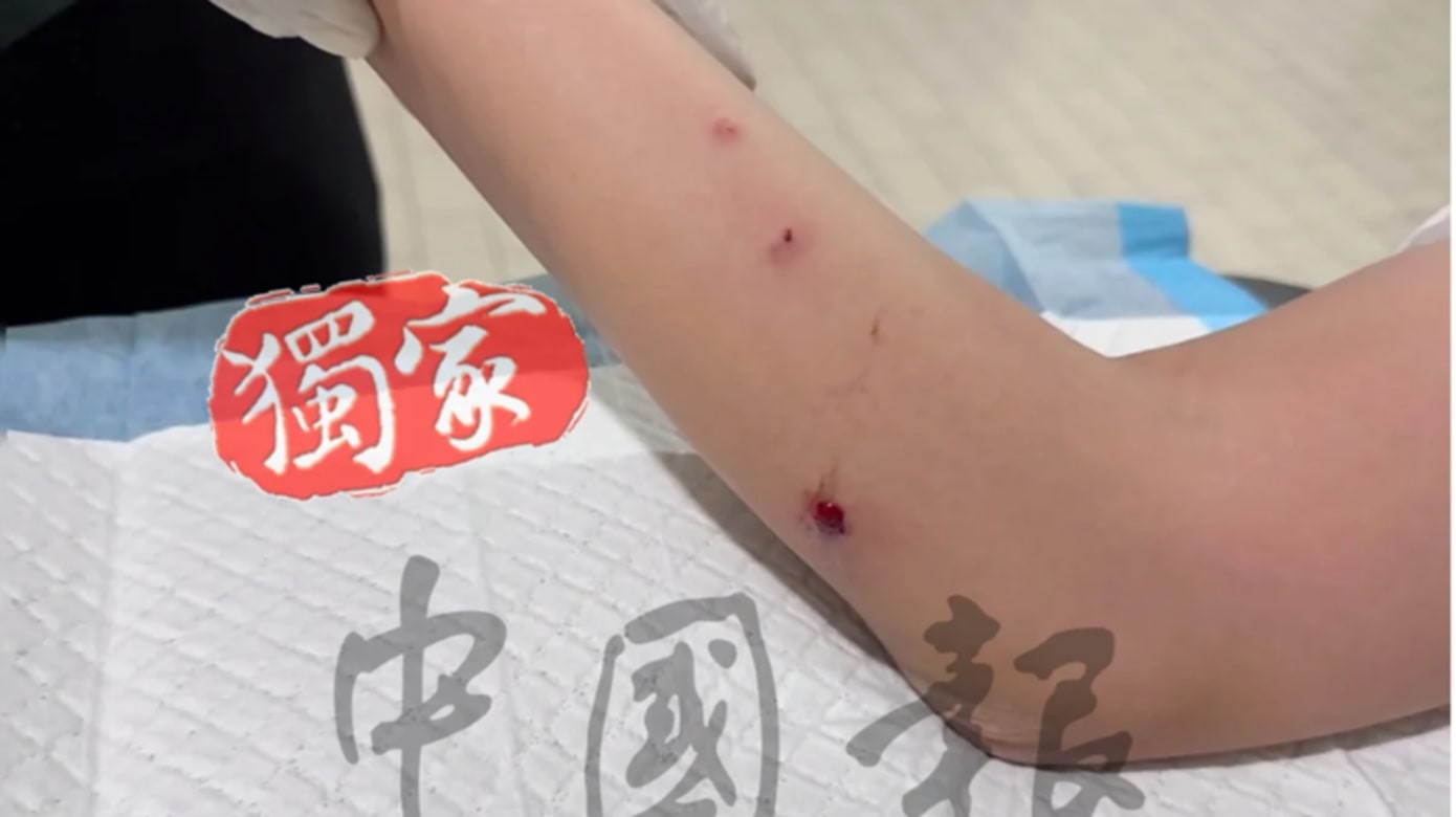 沙巴景区疑有人用气枪射游客 中国女游客受伤报警