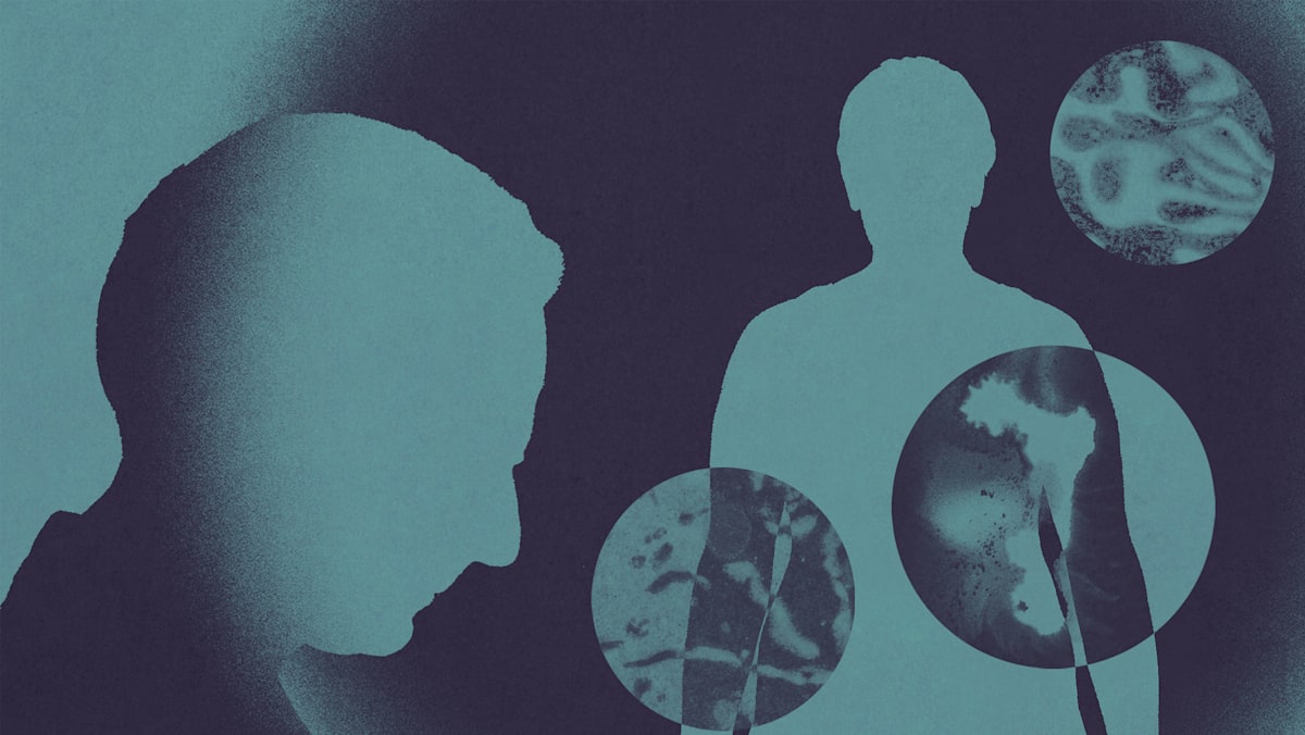 Why are more young people getting cancer today? Clues point back to the 1950s