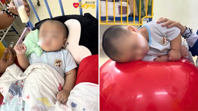 11个月男婴摔落脑受创 越堤族妈妈陪伴康复路