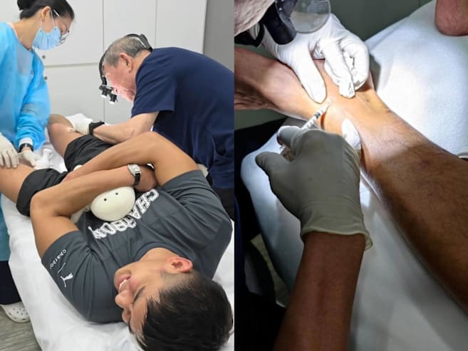 Elvin Ng had to get steroid jabs for sandfly bites after they became inflamed
