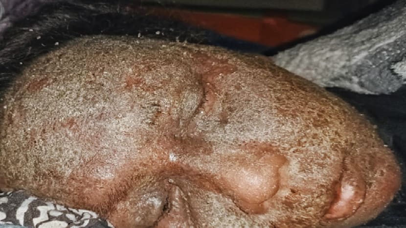 Related article image