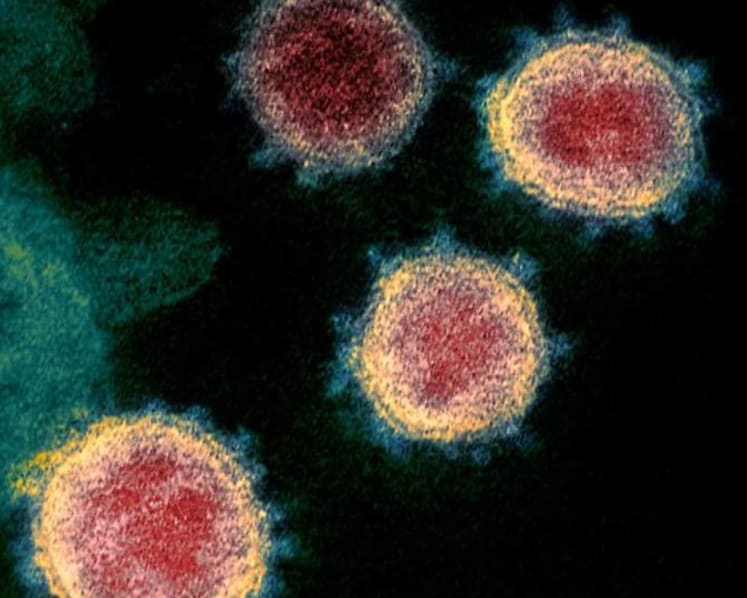 10 residents dead amid COVID-19 outbreak at Kansas nursing home