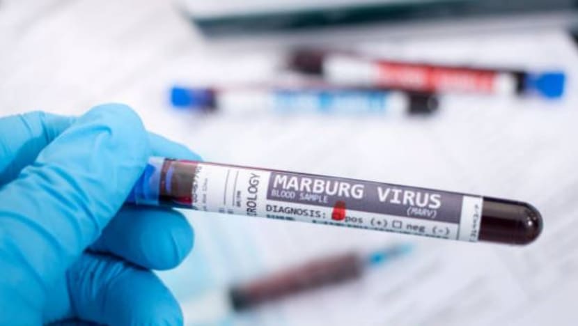 Rwanda lapor 6 kematian akibat jangkitan virus Marburg