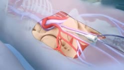 Related article image