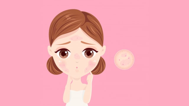 “敏感肌”困扰着你吗？