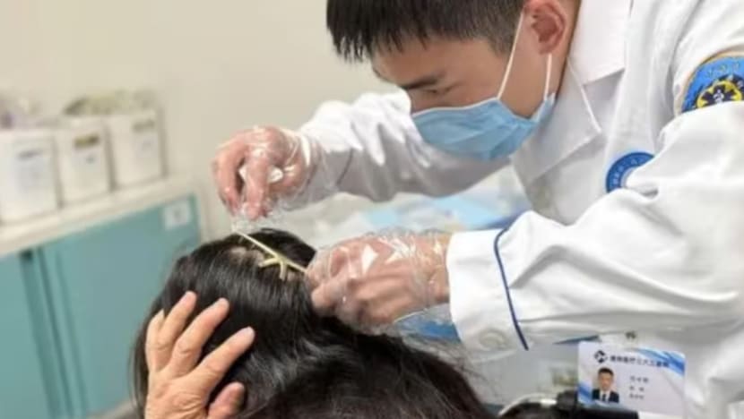 Sepit rambut wanita tercacak pada kepala susuli nahas jalan raya di China Sepit rambut wanita tercacak pada kepala susuli nahas jalan raya di China