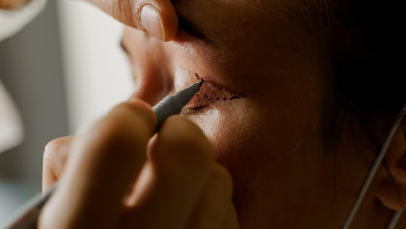 Beautician gets jail for unlicensed procedure that worsened woman's drooping eyelid
