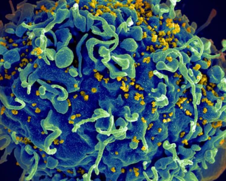 UN urges action to end AIDS, saying COVID-19 hurt progress