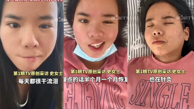 天热开电风扇吹四小时  中国女子午觉醒来竟口歪眼斜