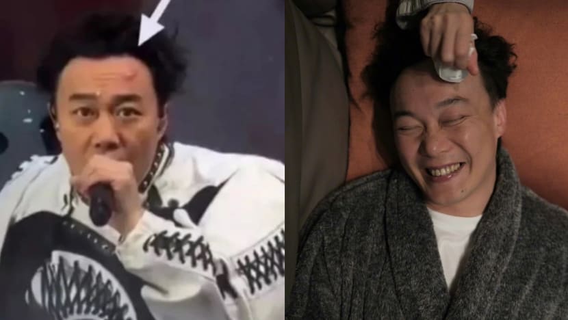 Eason Chan Gets Very Painful-Looking Bump On Forehead After Injuring Himself During Concert; Continues Performing Eason Chan Gets Very Painful-Looking Bump On Forehead After Injuring Himself During Concert; Continues Performing
