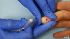 Related article image