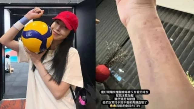 杨谨华打排球　上场不到10分钟，静脉血管爆掉！