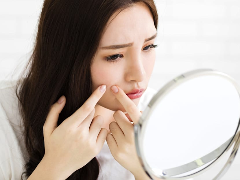 Thinking of popping that pimple? Don’t!