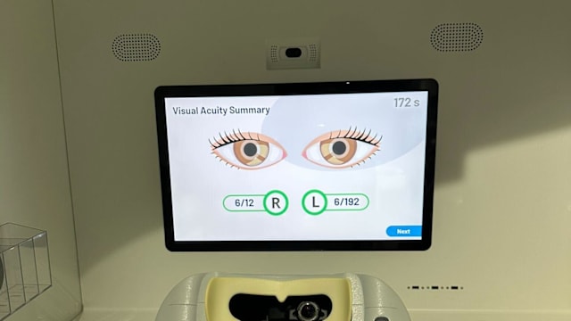 国大医院试行自助验眼设备 白内障筛查更快捷省时