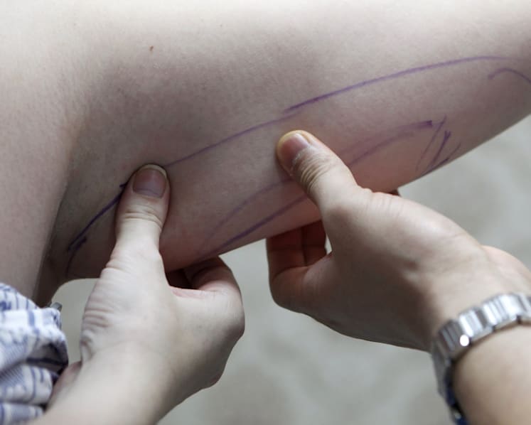 ‘Cooling off’ period for those considering aesthetic treatments