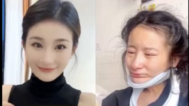 26岁中国女去年确诊患渐冻症 一年内去世