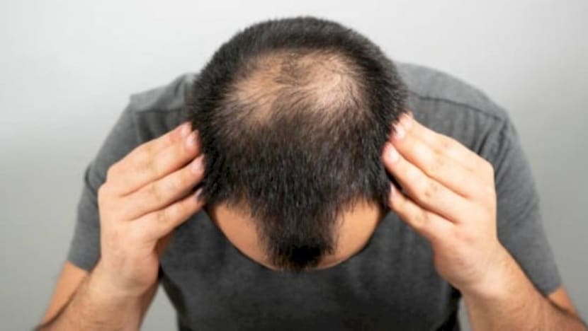 Rambut selalu gugur? Tabiat harian ini punca lelaki cepat botak Rambut selalu gugur? Tabiat harian ini punca lelaki cepat botak